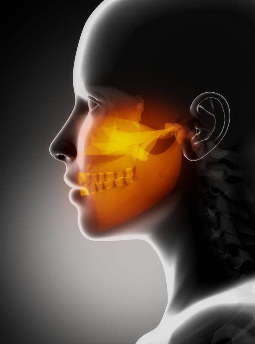Trismus - TMJ jaw pain
