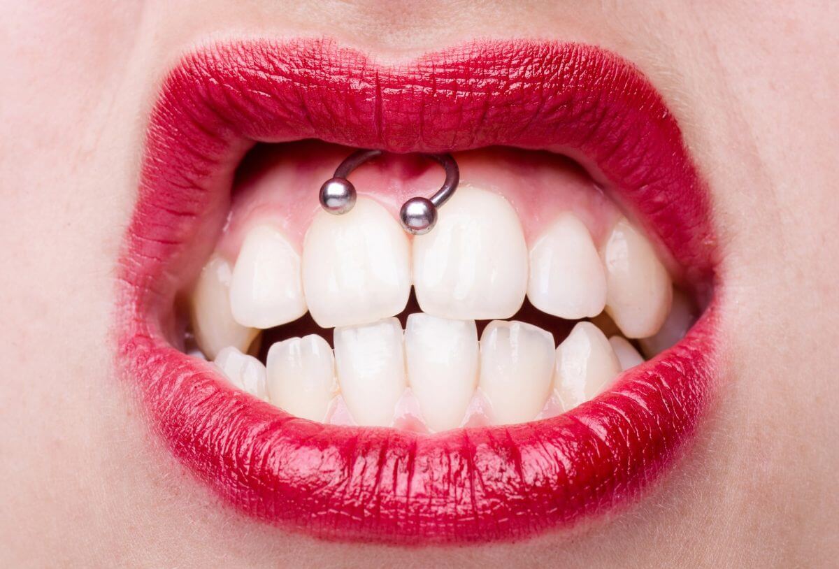 Oral Mouth Piercings can Cause Chipped or Cracked Teeth, Receding Gums, Enamel Wear and Tooth Mobility.