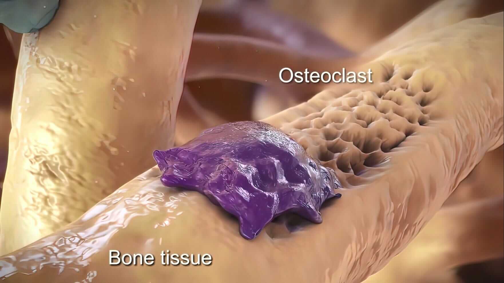 osteoclasts