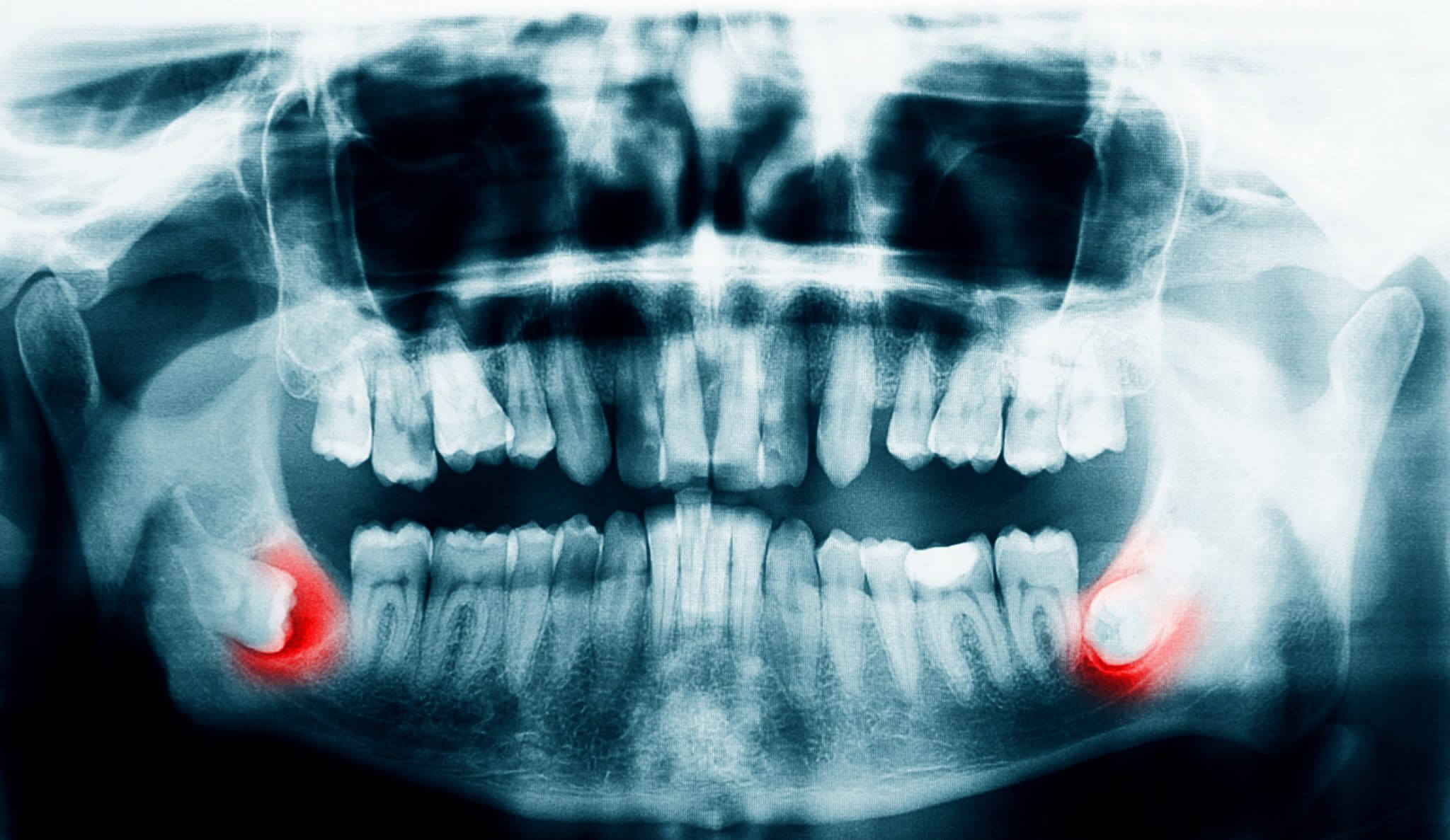 Dentist xrays and safety with radiation